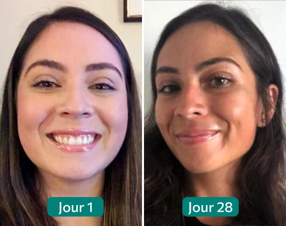 Two side-by-side images showing a woman's facial changes over 28 days.