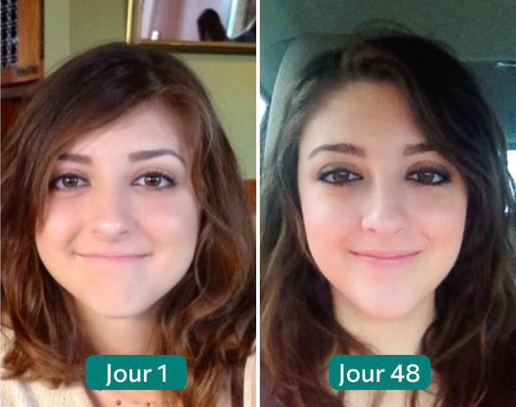 Two side-by-side photos of a person labeled 'Jour 1' and 'Jour 48.'