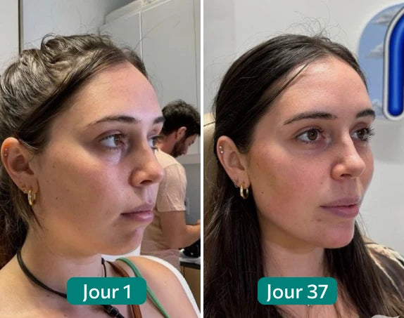 Side-by-side photo comparison of a woman's face on Day 1 and Day 37.